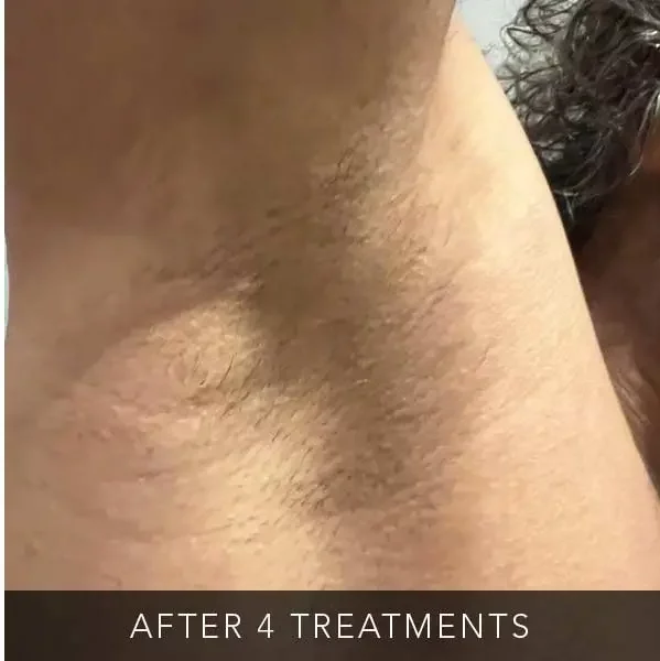 After-bodytwo