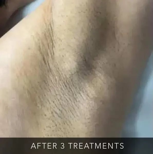 Before-bodytwo