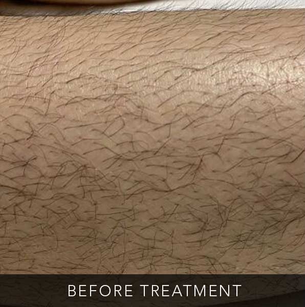 Before-facetwo